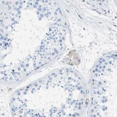 Immunohistochemistry-Paraffin: EB2 Antibody [NBP1-84926]