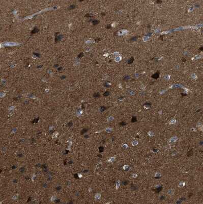 Immunohistochemistry-Paraffin: EB2 Antibody [NBP1-84926]