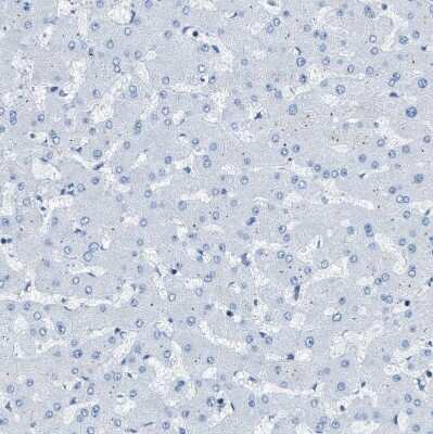 Immunohistochemistry-Paraffin: EB2 Antibody [NBP1-84926]