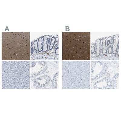 Immunohistochemistry-Paraffin: EB2 Antibody [NBP1-84927]