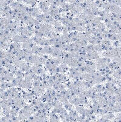 Immunohistochemistry-Paraffin: EB2 Antibody [NBP1-84927]