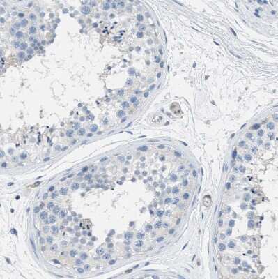 Immunohistochemistry-Paraffin: EB2 Antibody [NBP1-84927]