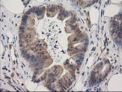 Immunohistochemistry: EB2 Antibody (OTI1F3) - Azide and BSA Free [NBP2-71650]