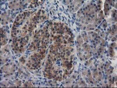 Immunohistochemistry: EB2 Antibody (OTI1F3) - Azide and BSA Free [NBP2-71650]