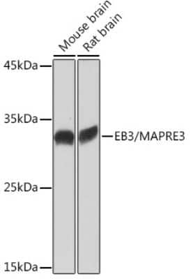 Western Blot: EB3 Antibody (7J9V3) [NBP3-15904]