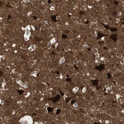 Immunohistochemistry-Paraffin: EB3 Antibody [NBP1-84924]