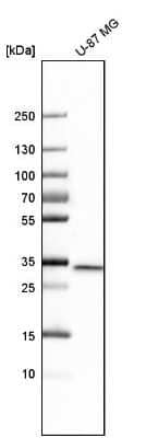 Western Blot: EB3 Antibody [NBP1-84924]