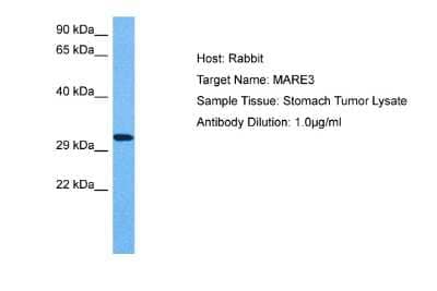 Western Blot: EB3 Antibody [NBP2-87319]