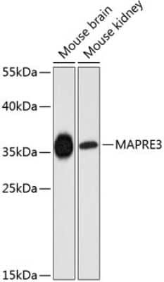 Western Blot: EB3 AntibodyAzide and BSA Free [NBP2-92839]