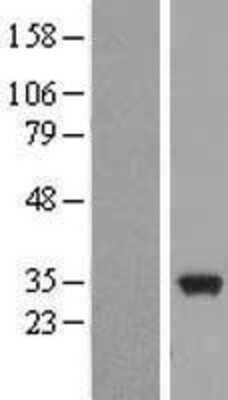 Western Blot: EB3 Overexpression Lysate [NBL1-12893]