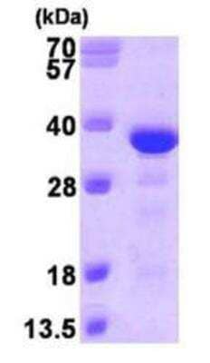 SDS-PAGE: Recombinant Human EB3 His Protein [NBP1-49432]