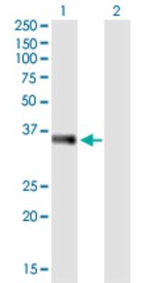 Western Blot: EBAG9/RCAS1 Antibody (4A10) [H00009166-M04]