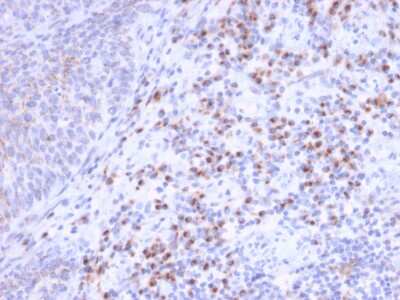 Immunohistochemistry-Paraffin: EBAG9/RCAS1 Antibody (CPTC-EBAG9-1) - Azide and BSA Free [NBP3-08859]