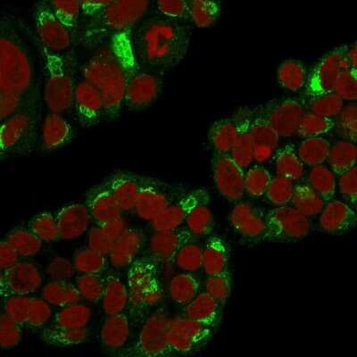 Immunocytochemistry/ Immunofluorescence: EBAG9/RCAS1 Antibody (CPTC-EBAG9-1) [NBP3-07534]