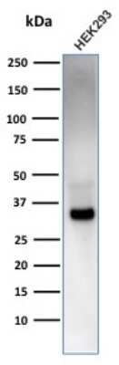 Western Blot: EBAG9/RCAS1 Antibody (CPTC-EBAG9-2)Azide and BSA Free [NBP3-08860]