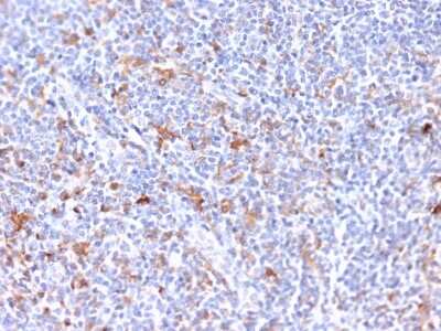 Immunohistochemistry-Paraffin: EBAG9/RCAS1 Antibody (CPTC-EBAG9-2) [NBP3-07535]