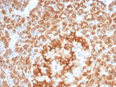 Immunohistochemistry-Paraffin: EBAG9/RCAS1 Antibody (EBAG9/7033R) [NBP3-13811]