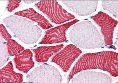 Immunohistochemistry-Paraffin: EBAG9/RCAS1 Antibody [NB100-41096]