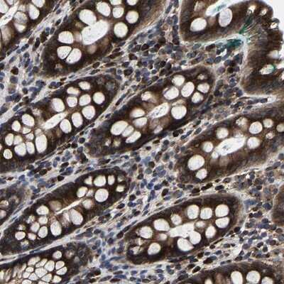 Immunohistochemistry-Paraffin: EBAG9/RCAS1 Antibody [NBP1-84922]