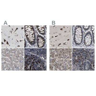 Immunohistochemistry-Paraffin: EBAG9/RCAS1 Antibody [NBP1-84922]