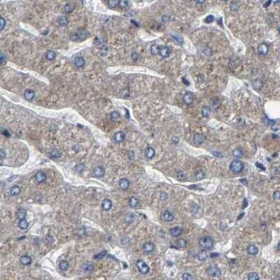 Immunohistochemistry-Paraffin: EBAG9/RCAS1 Antibody [NBP1-84922]