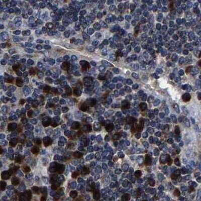Immunohistochemistry-Paraffin: EBAG9/RCAS1 Antibody [NBP1-84922]