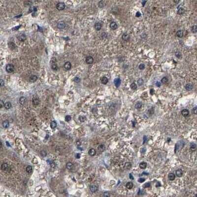 Immunohistochemistry-Paraffin: EBAG9/RCAS1 Antibody [NBP1-84923]