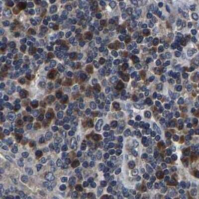 Immunohistochemistry-Paraffin: EBAG9/RCAS1 Antibody [NBP1-84923]