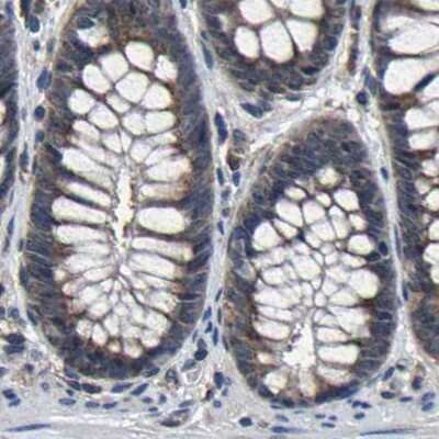 Immunohistochemistry-Paraffin: EBAG9/RCAS1 Antibody [NBP1-84923]