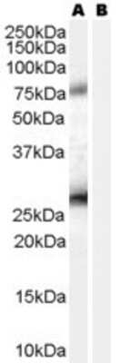 Western Blot: EBAG9/RCAS1 Antibody [NB100-41096]