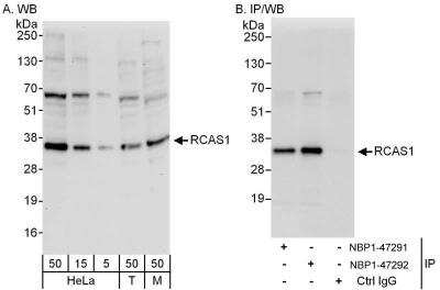 Western Blot: EBAG9/RCAS1 Antibody [NBP1-47292]