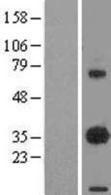 Western Blot: EBAG9/RCAS1 Overexpression Lysate [NBL1-10090]