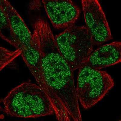 Immunocytochemistry/ Immunofluorescence: EBF-1 Antibody [NBP2-56773]