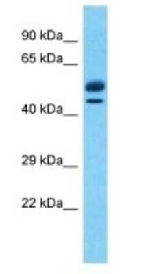 Western Blot: EBF-2 Antibody [NBP3-09213]