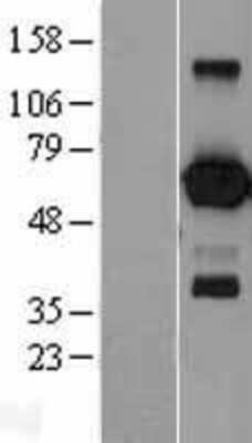 Western Blot: EBF-1 Overexpression Lysate [NBL1-10091]