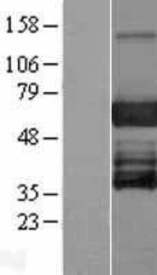 Western Blot: EBF-3 Overexpression Lysate [NBP2-08863]