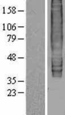 Western Blot: EBI2/GPR183 Overexpression Lysate [NBL1-10092]