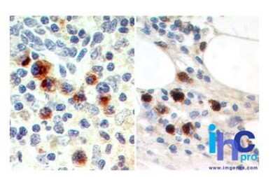 Immunohistochemistry-Paraffin: EBI3 Antibody (15k8D10) - BSA Free [NBP2-27362]