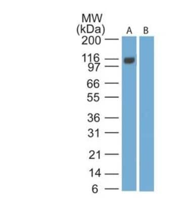 Western Blot: EBI3 Antibody (15k8D10)BSA Free [NBP2-27362]