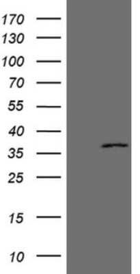 Western Blot: EBLN2 Antibody (OTI2H1) [NBP2-46481]