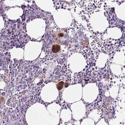 Immunohistochemistry: EBLN2 Antibody [NBP2-49572]