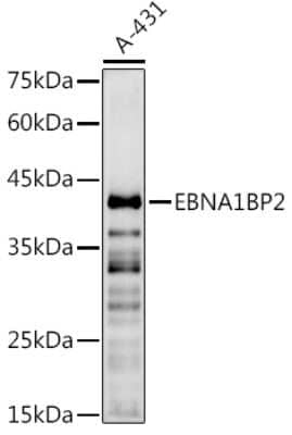 Western Blot: EBNA1BP2 AntibodyBSA Free [NBP2-92575]