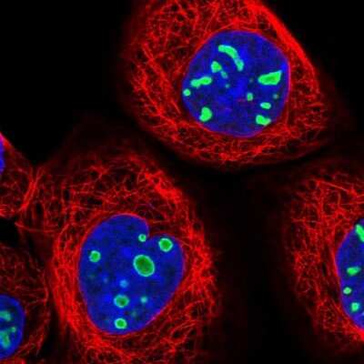 Immunocytochemistry/ Immunofluorescence: EBNA1BP2 Antibody [NBP1-84022]