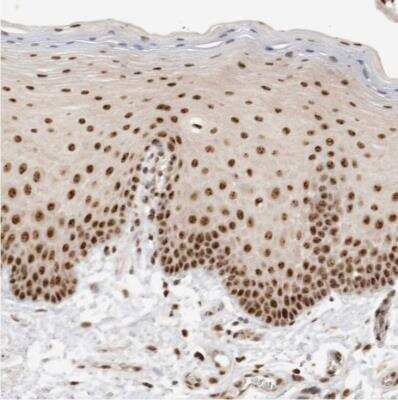 Immunohistochemistry-Paraffin: EBNA1BP2 Antibody [NBP1-84022]