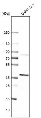 Western Blot: EBNA1BP2 Antibody [NBP1-84022]