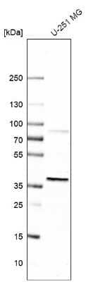 Western Blot: EBNA1BP2 Antibody [NBP1-84022]