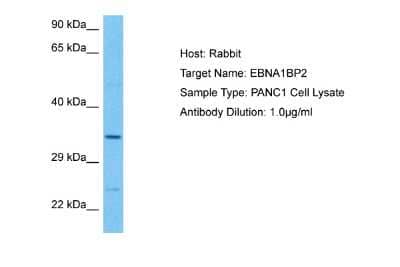 Western Blot: EBNA1BP2 Antibody [NBP2-82700]