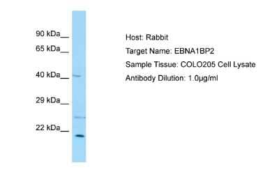 Western Blot: EBNA1BP2 Antibody [NBP2-82966]