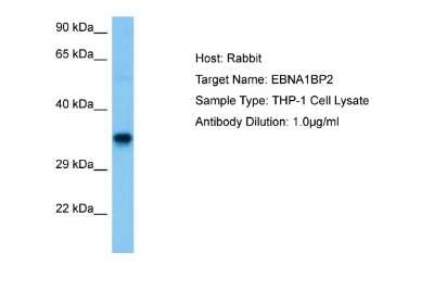 Western Blot: EBNA1BP2 Antibody [NBP2-82970]