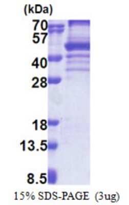 SDS-PAGE: Recombinant Human EBNA1BP2 His Protein [NBP2-23016]